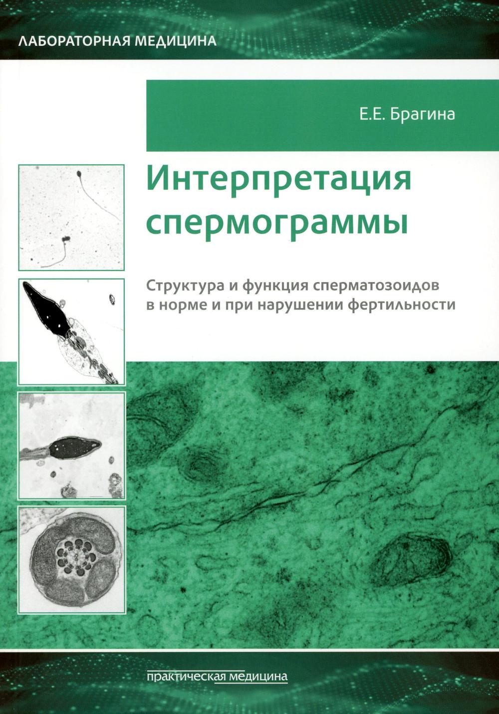 Интерпретация спермограммы. Структура и функция сперматозоидов в норме и при нарушении фертильности***