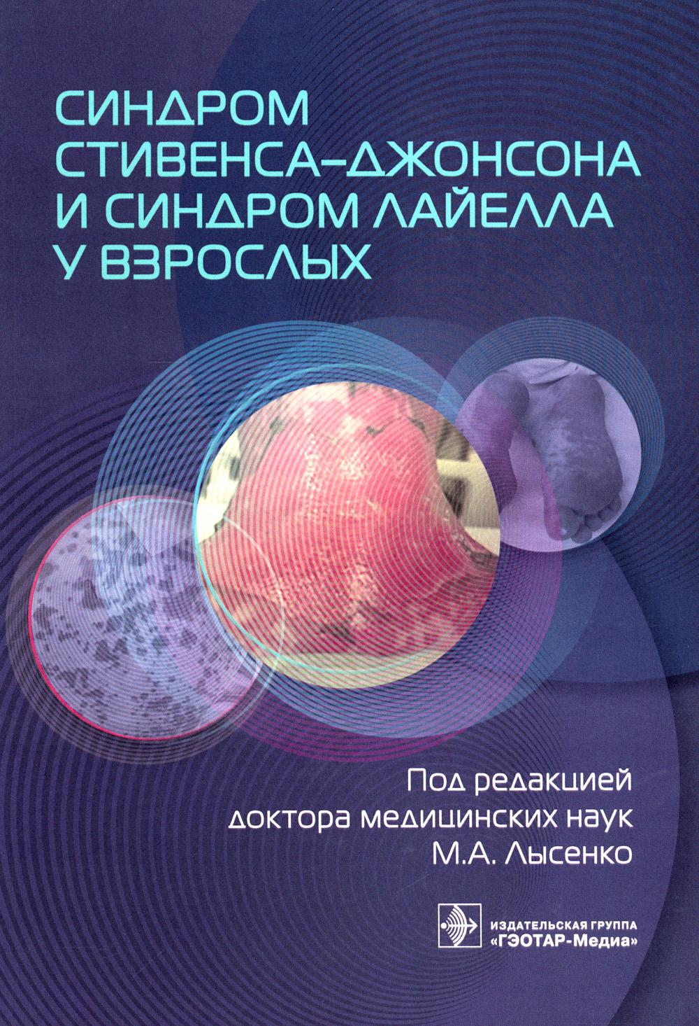 Синдром Стивенса–Джонсона и синдром Лайелла у взрослых / под ред. М. А. Лысенко. — Москва : ГЭОТАР-Медиа, 2023. — 96 с.