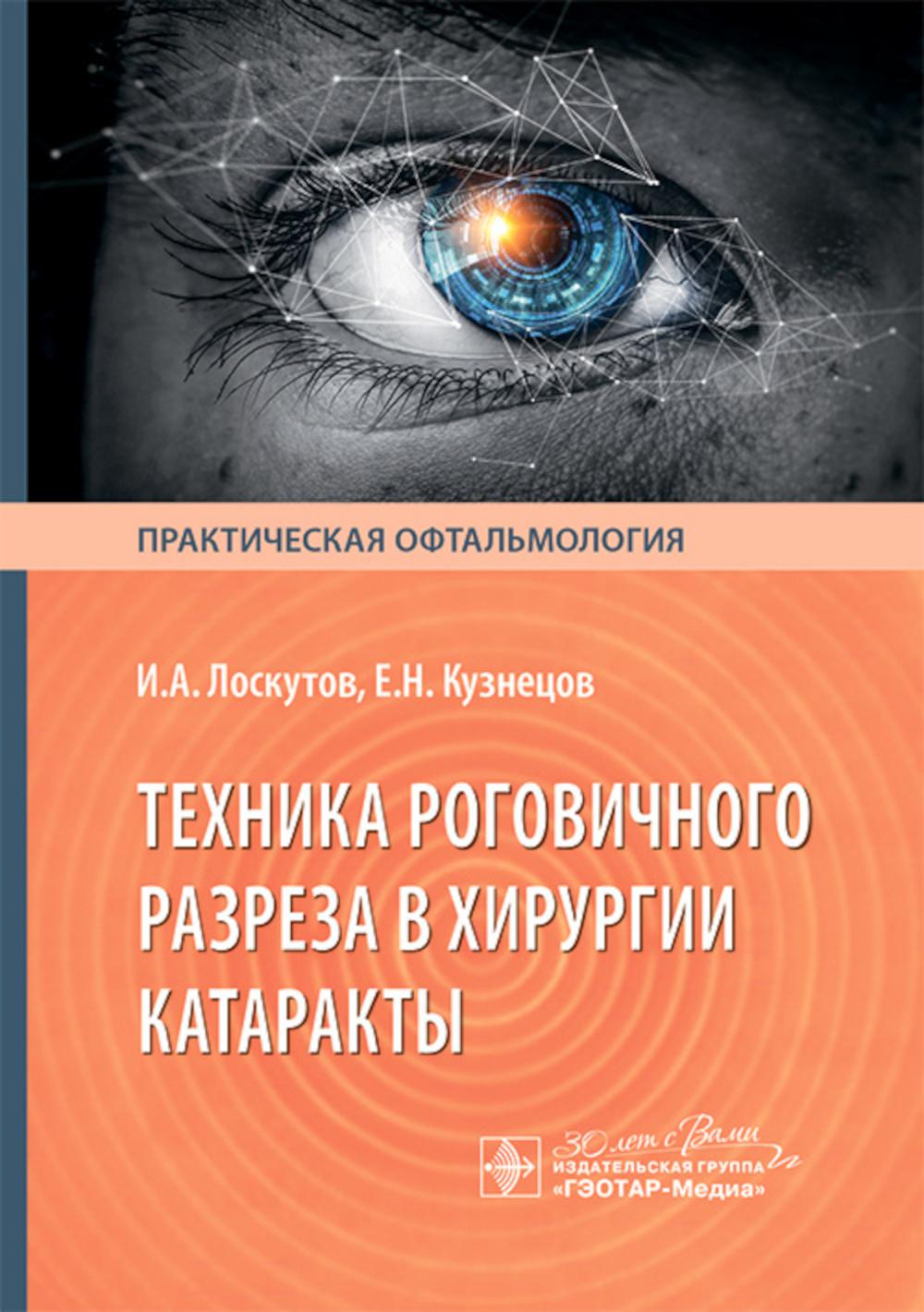 Техника роговичного разреза в хирургии катаракты / И. А. Лоскутов, Е. Н. Кузнецов. — Москва : ГЭОТАР-Медиа, 2025. — 144 с. : ил. — (Серия «Практическая офтальмология»).