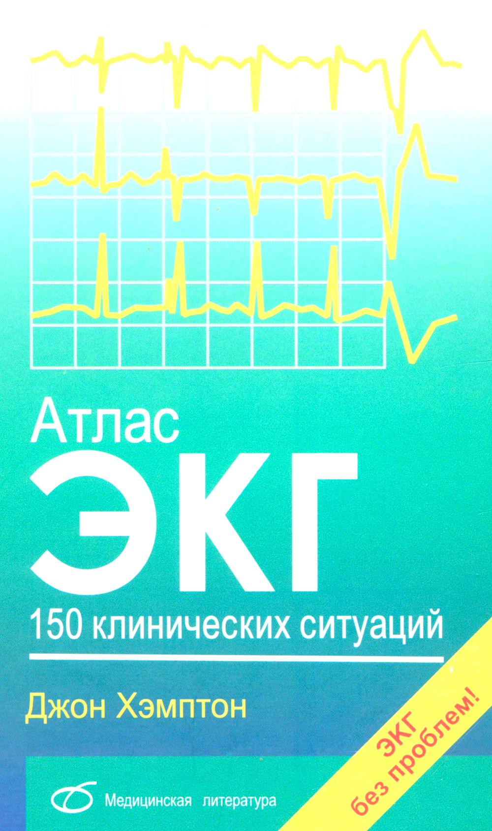 Атлас ЭКГ: 150 клинических ситуаций