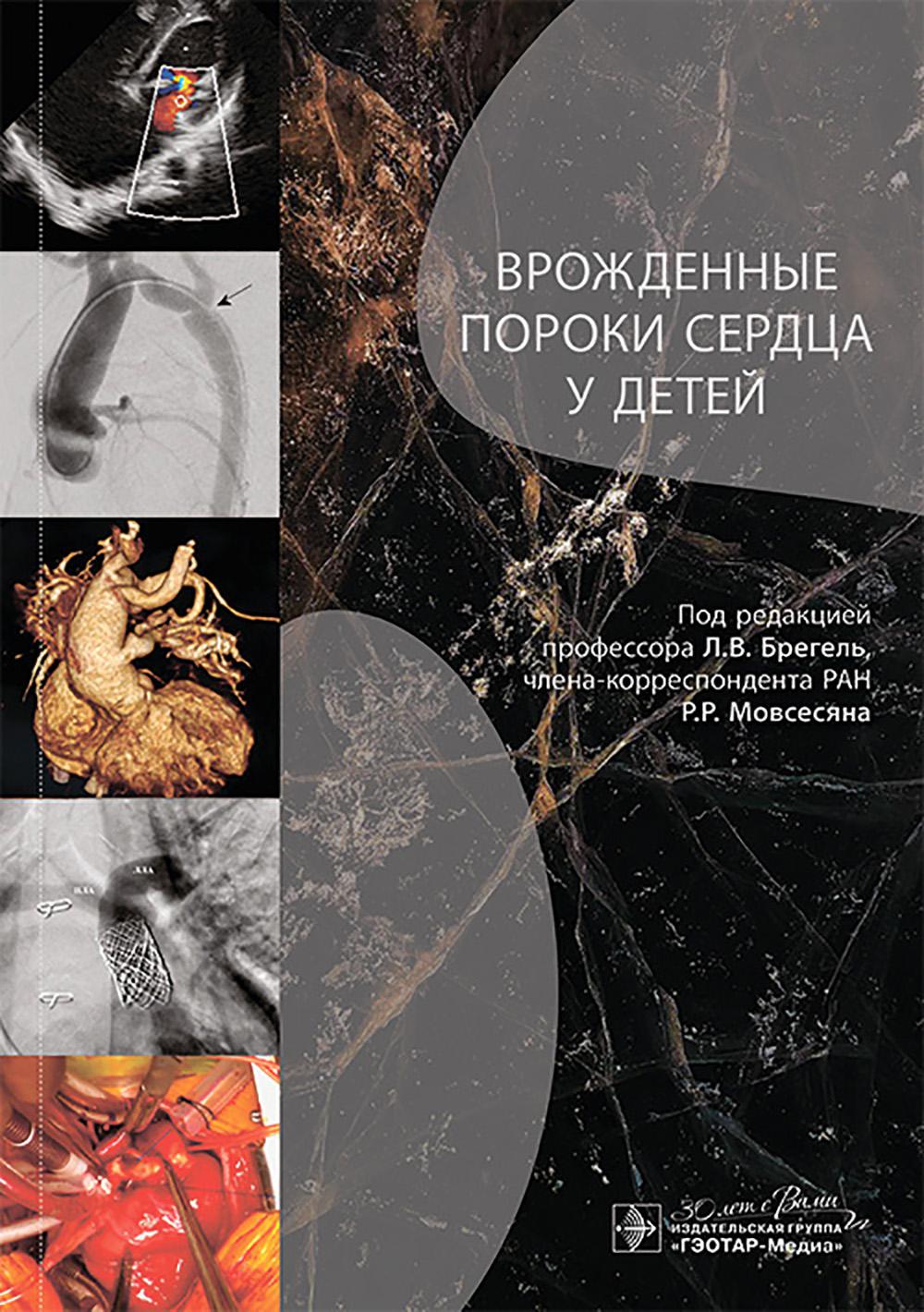 Врожденные пороки сердца у детей : руководство для врачей / под ред. Л. В. Брегель, Р. Р. Мовсесяна. — Москва : ГЭОТАР-Медиа, 2025. — 448 с. : ил.