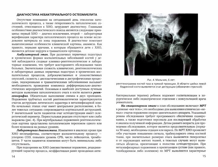Хронический небактериальный остеомиелит в детской хирургической практике: учебно-методическое пособие