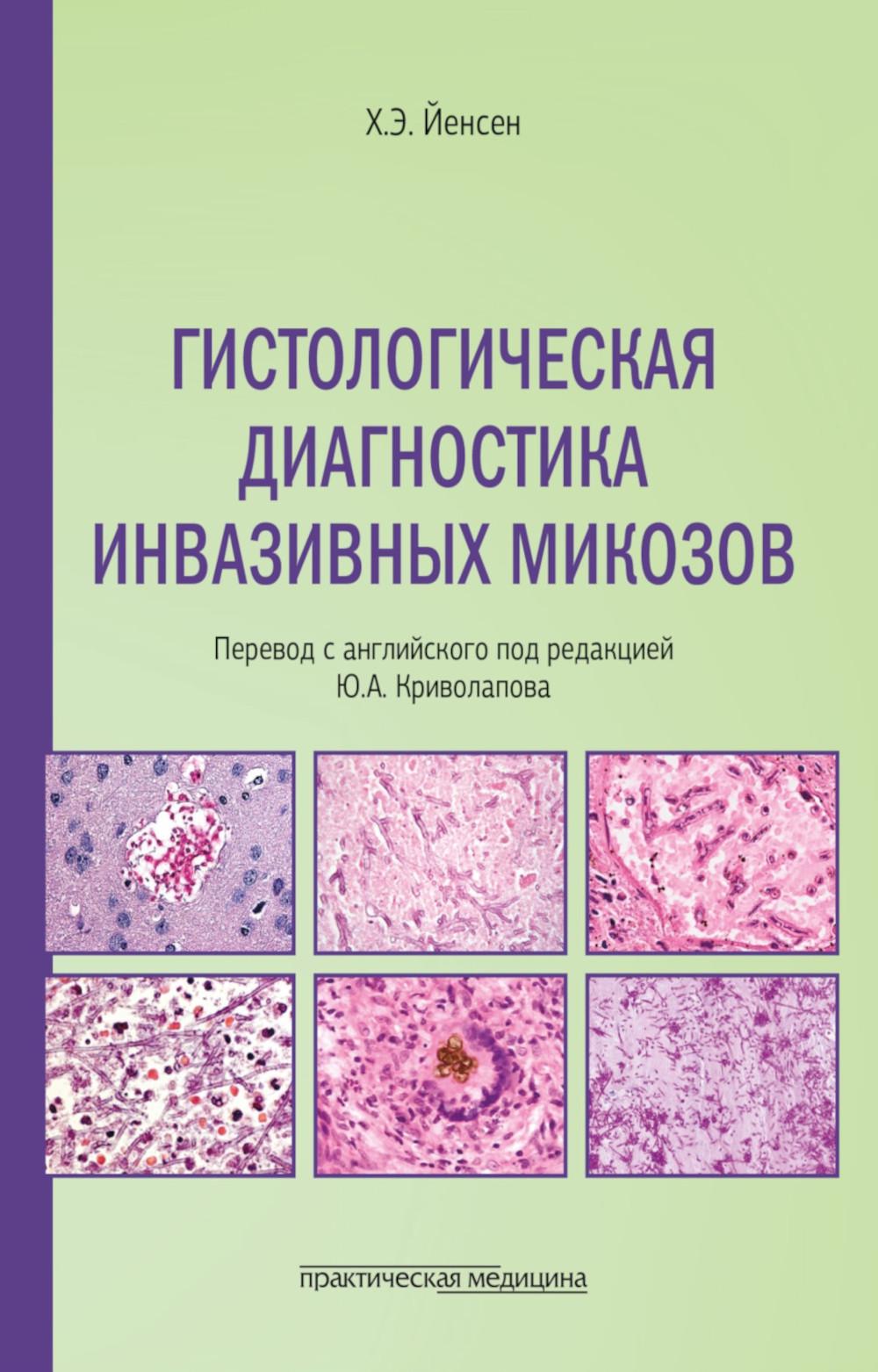 Гистологическая диагностика инвазивных микозов