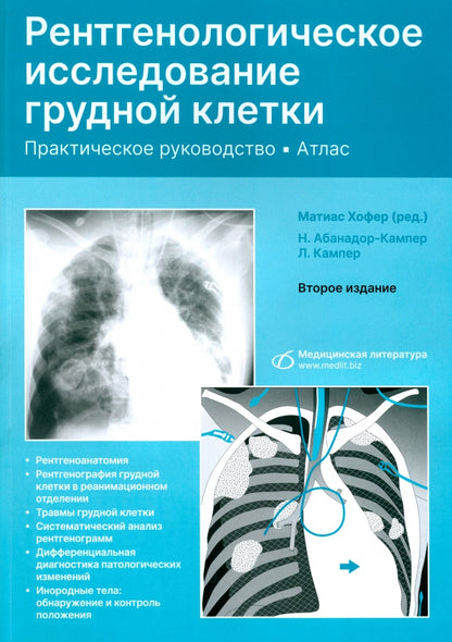 Рентгенологическое исследование грудной клетки. Практическое руководство. Атлас. 2-е изд., перераб.и доп