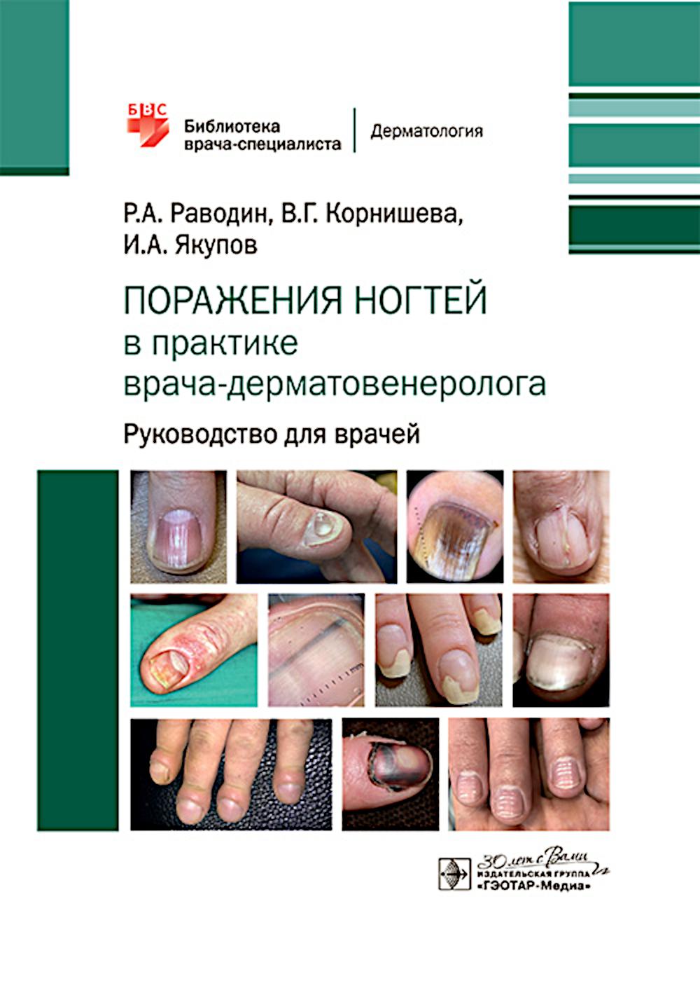 Поражения ногтей в практике врача-дерматовенеролога : руководство для врачей / Р. А. Раводин, В. Г. Корнишева, И. А. Якупов. — Москва : ГЭОТАР-Медиа, 2025. — 176 с. : ил. — (Серия «Библиотека врача-специалиста»).