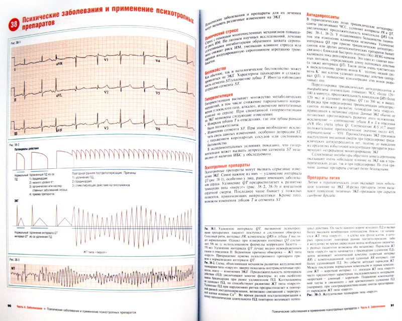 Наглядная ЭКГ