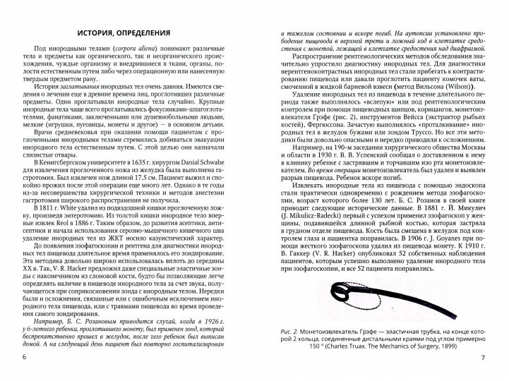 Инородные тела ЖКТ у детей: учебное пособие