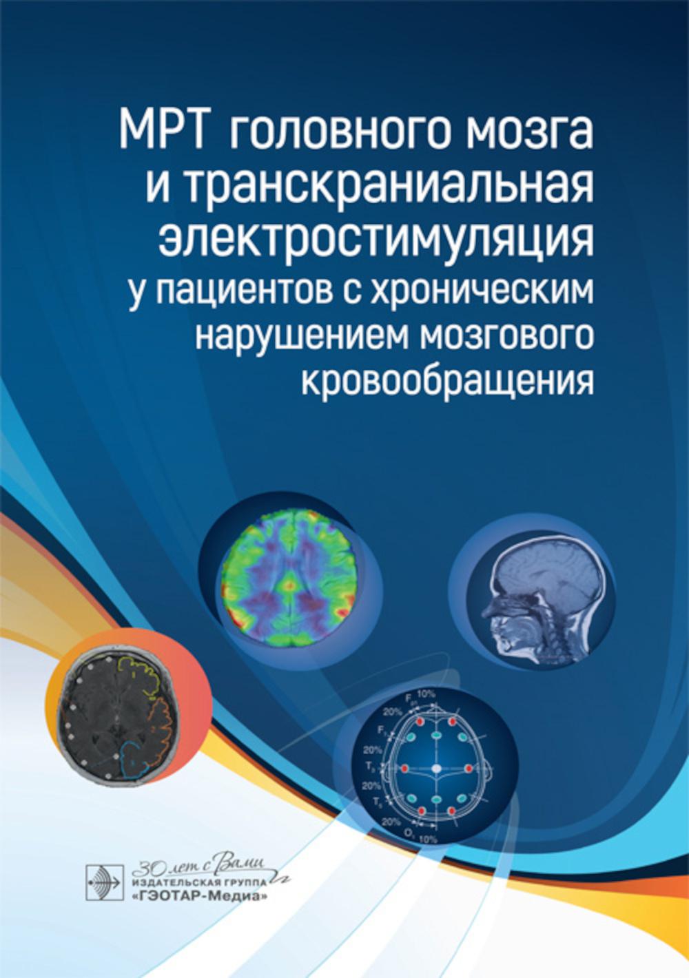 МРТ головного мозга и транскраниальная электростимуляция у пациентов с хроническим нарушением мозгового кровообращения / Т. Г. Морозова, А. В. Борсуков, Е. С. Чухонцева [и др.]. — Москва : ГЭОТАР-Медиа, 2024. — 96 с. : ил.