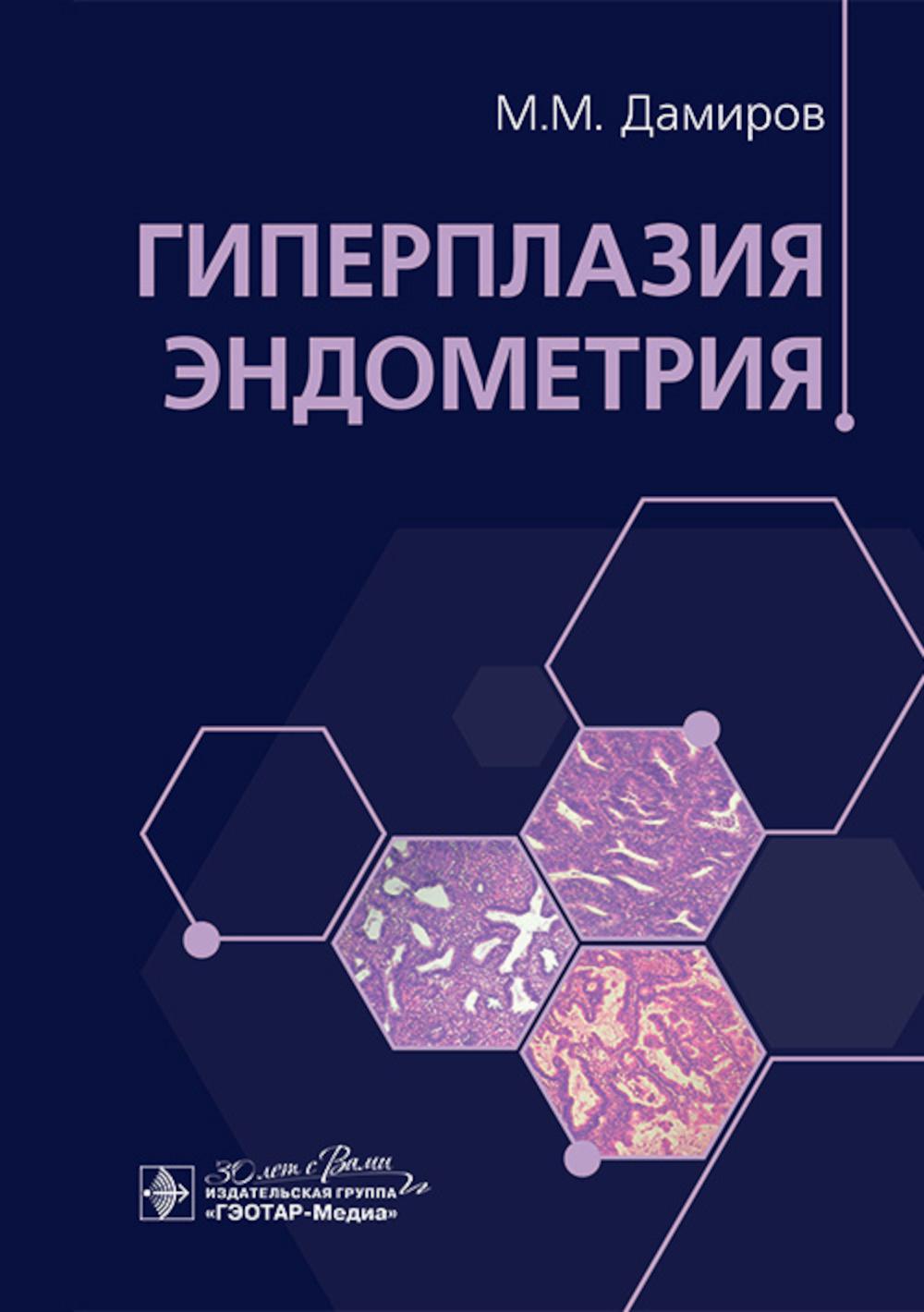 Гиперплазия эндометрия / М. М. Дамиров [и др.]. — Москва : ГЭОТАР-Медиа, 2023. — 232 с. : ил.